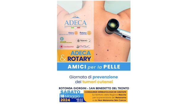 San Benedetto del Tronto, evento dedicato alla prevenzione dei tumori cutanei organizzata da Società Scientifica ADECA