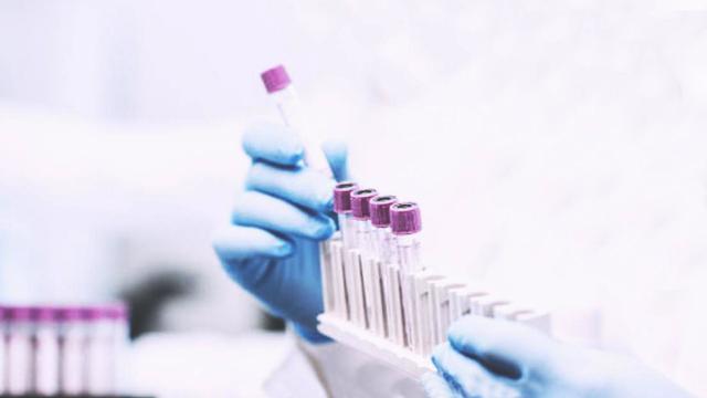 Quattro comuni Covid free nella provincia di Ascoli. Focus su positivi e persone in quarantena nel Piceno