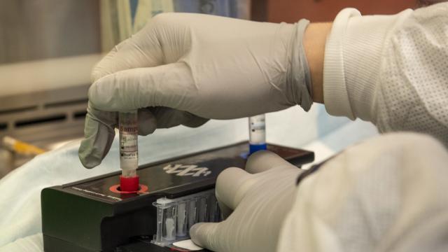 Coronavirus Marche: quasi 350 i nuovi casi, resta alto tasso positività. La situazione nel Piceno