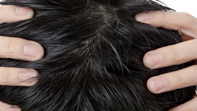 Gestire l’eccesso di sebo sui capelli: consigli e suggerimenti
