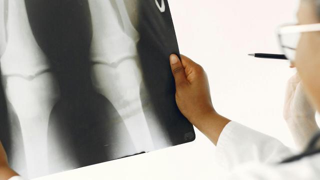 San Benedetto del Tronto, convegno sull'osteoporosi promosso dal Soroptimist International di Ascoli Piceno