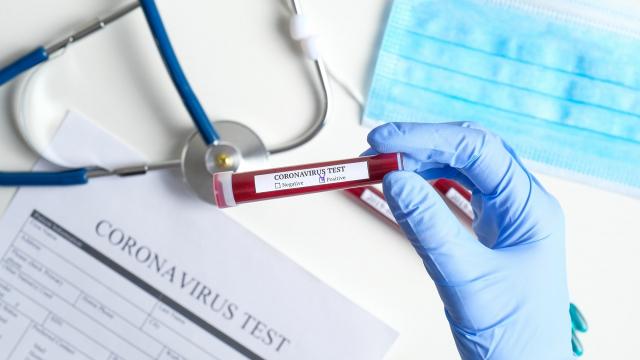 Coronavirus, altri 15 casi positivi nel Piceno. Otto tra Offida e San Benedetto del Tronto
