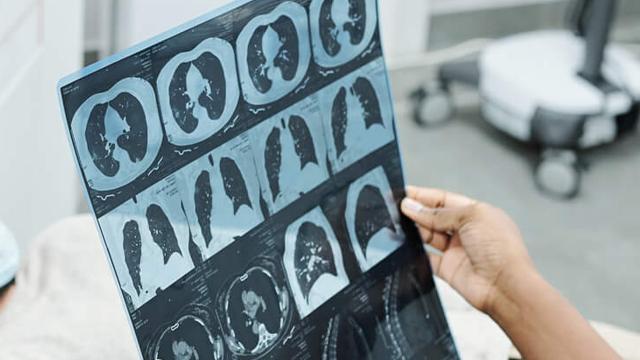 AST Ascoli, aggiornamento tecnologico per la risonanza magnetica dell’ospedale di San Benedetto del Tronto