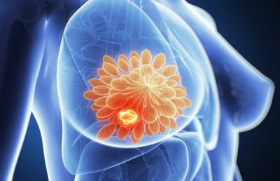 Iom Ascoli, iniziativa ''Traguardo Prevenzione'' per sensibilizzare sul carcinoma mammario