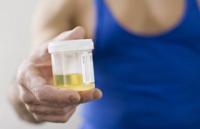  Screening del cancro con un semplice test delle urine