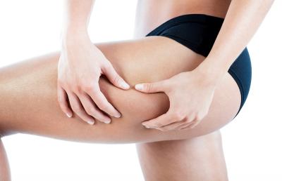 Cellulite, cos’è e come contrastarla