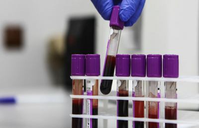 Coronavirus, dalla Russia un farmaco per curare pazienti a prescindere da gravità condizioni
