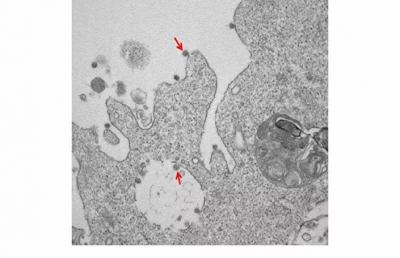 Coronavirus, presentate prime immagini al microscopio del ceppo italiano Sars-CoV-2