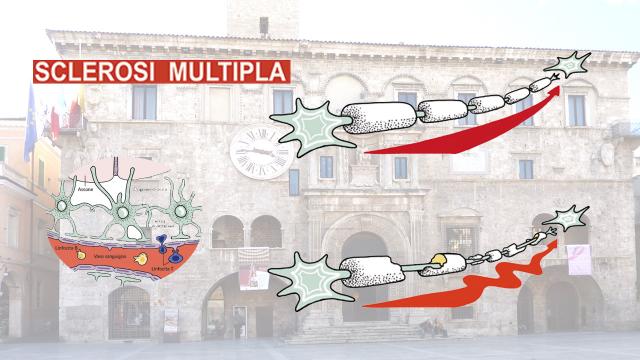 Ascoli Piceno, in programma convegno dedicato all’approfondimento sulla Sclerosi Multipla