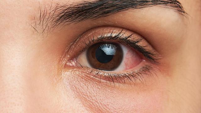 Integrazione mirata anti-invecchiamento e possibili vantaggi per la salute degli occhi 