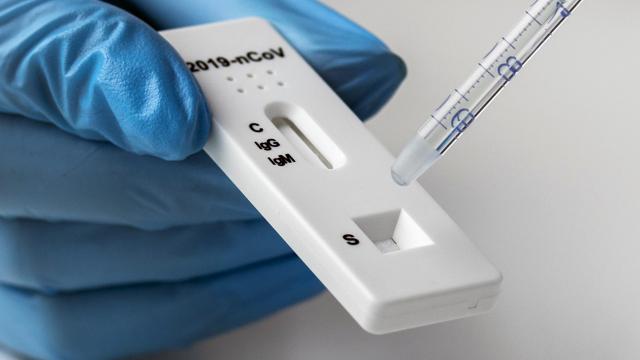 Covid Marche: aggiornamento settimana 30 Dicembre-6 Gennaio. Diminuiscono ricoveri e tasso incidenza 
