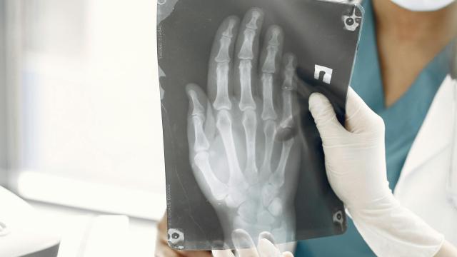 Comunicato Sindacale AST di Ascoli Piceno: “Per la radiologia lavoro straordinario in luogo di quello ordinario”