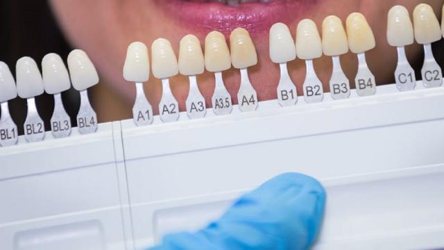 Sorriso, l'ingrediente segreto (approvato dalla scienza) per la soddisfazione sul lavoro e nella vita