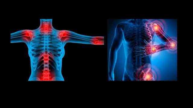 Grottammare, luci sulla ''Giornata mondiale della Fibromialgia''
