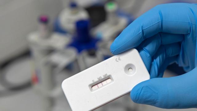 Regione Marche, da prossima settimana farmacie a disposizione per tamponi antigenici rapidi