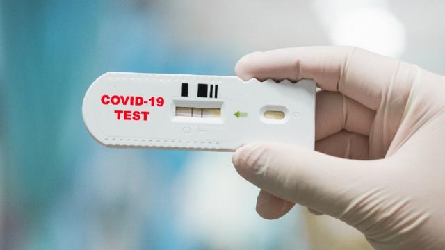 Covid: Federfarma Ascoli, tamponi antigenici rapidi in circa 30 farmacie del Piceno