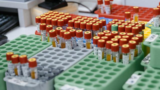 Regione Marche, interruzione programmata del servizio CUP per aggiornamento informatico