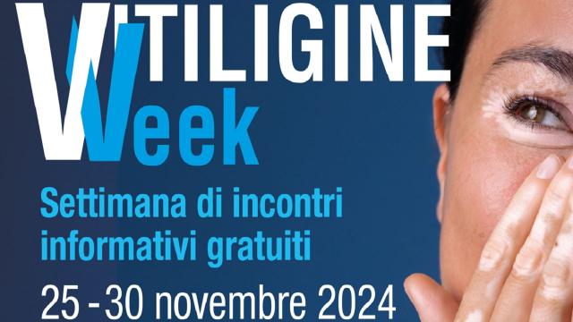 La Vitiligine Week arriva nelle Marche: incontri gratuiti con i dermatologi dedicati ai pazienti