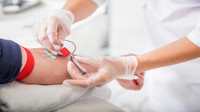 Studio rivoluzionario: l'analisi del sangue può identificare individui sani a maggior rischio di cancro